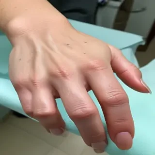 hospital patient hand pic