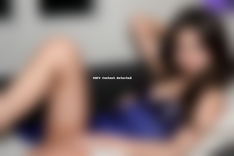 selena gomez broken arm