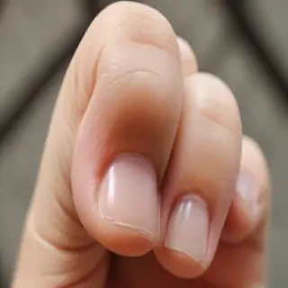 asian thumbs