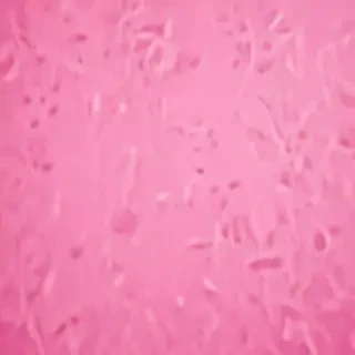 pink zoom background