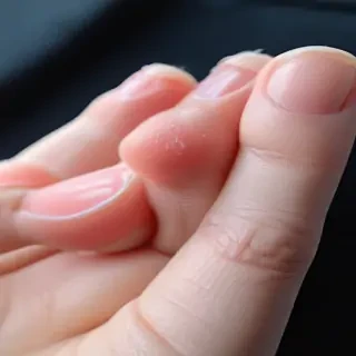 cat paw