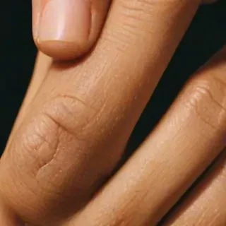 asian thumbs