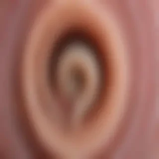 ring worm images
