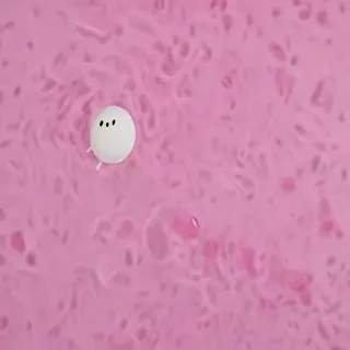 aesthetic blob