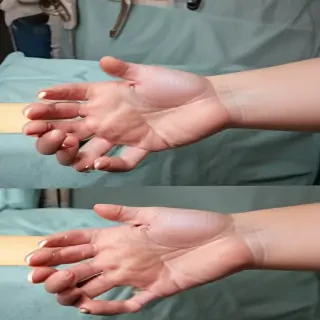 hospital patient hand pic
