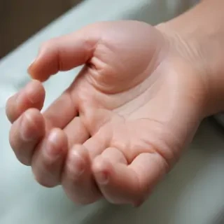 hospital patient hand pic