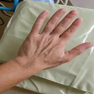 hospital patient hand pic