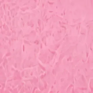 pink zoom background