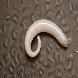ring worm images