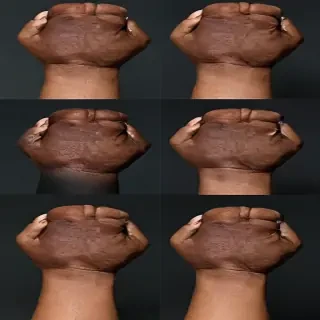 black thumbs