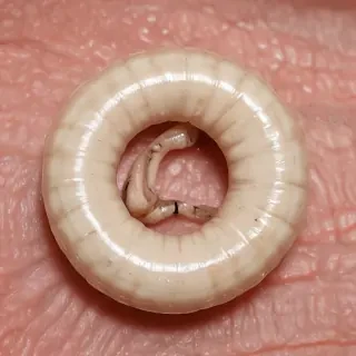 ring worm images