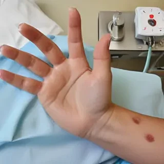 hospital patient hand pic