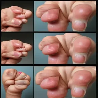asian thumbs