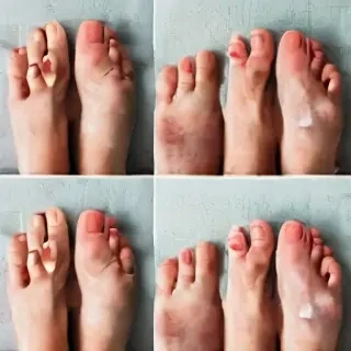 foot images