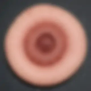 images of ringworm