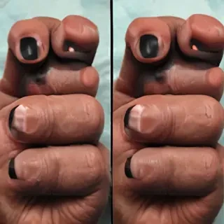 black thumbs