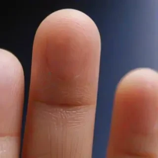 finger picture