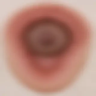 images of ringworm