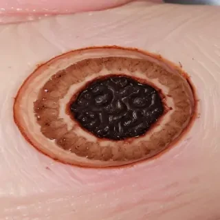 images of ringworm