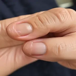 asian thumbs